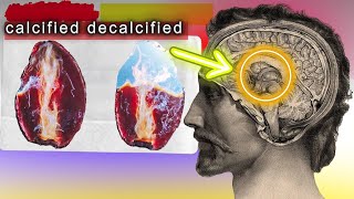 The Secret To Decalcifying The Pineal Gland  HOW TO [upl. by Myrta]