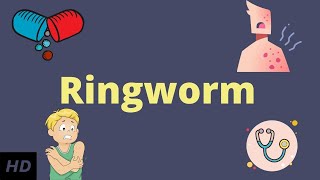 Ringworm Causes Signs and Symptoms Diagnosis and Treatment [upl. by Eicnarf]