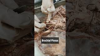 Brachial plexus 1  Anatomy Upper Limb  mbbs neet viral shorts [upl. by Surat]