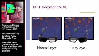 SDampA 2015 Interactive stereo games to improve vision in children with amblyopia… 93918 [upl. by Bej]