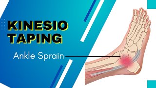 How to Apply kinesiology Tape for an Ankle Inversion Sprain [upl. by Ainalem313]