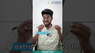 Dry Socket Dilemma  SRM Kattankulathur Dental College amp Hospital  SRMIST [upl. by Aitnohs]