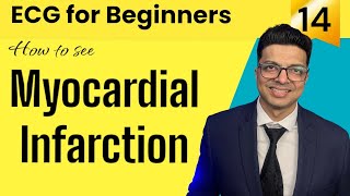 ECG for Beginners  How to see MYOCARDIAL INFARCTION in ECG  जानिए Evolution of MI in ECG [upl. by Kinney]