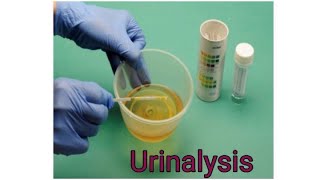 URINALYSIS  How to perform Urinalysis  Urine Dipstick [upl. by Nabe]