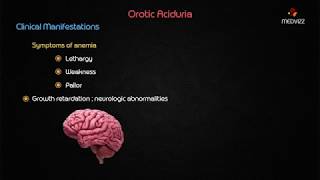 Orotic aciduria  Usmle biochemistry case based discussion [upl. by Ramma]