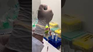 Journey into Peripheral Blood Mononuclear Cell Isolation StepbyStep Guide PBMCIsolation [upl. by Iveson]