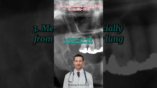 Jaw Bone Mysteries SOLVED Radiologist Reveals All  Lytic bony lesions of Mandible amp Maxilla [upl. by Carbo789]