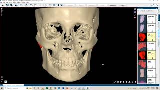 Webinar Orthodontics The best solution for your Ortho treatmentsEnglish [upl. by Marrissa]