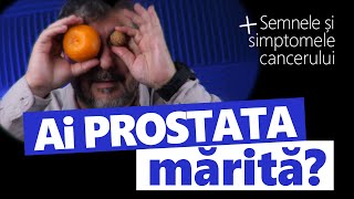 Ce Înseamnă Prostata Mărită Când e CANCER [upl. by Mittel]