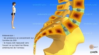 Vidéo sonorisée Placement du bassin  charnière lombosacrée [upl. by Koffman]