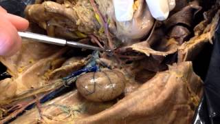 Cat Dissection  Abdominal Arteries [upl. by Hepsoj]