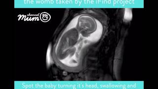 MRI Scan Video of Baby Moving in Womb  Channel Mum [upl. by Petunia]