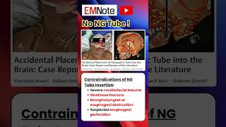 NG Tube Contraindications nursing doctor medical [upl. by Schou279]