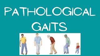 PATHOLOGICAL  ABNORMAL GAITS PART1 PRACTICAL DEMONSTRATION IN URDU  HINDI [upl. by Domenic]