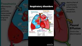 LUNG DISEASES aiapget shorts viralvideo neetpg [upl. by Tracee148]