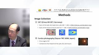 Multidimensional imaging model for screening of primary open angle glaucoma G Wang China [upl. by Ennayelsel]