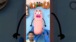 Cartoonfunnyhab  Sunege surgery 😂😱 shorts goodland animation doodletales cartoon funnydoodle [upl. by Alleen]