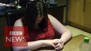 Narcolepsy What is it like to have a cataplexy attack  BBC News [upl. by Okihsoy]