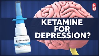 Ketamine as a Treatment for Depression [upl. by Lizette]