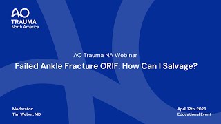 AO Trauma NA Webinar—Failed Ankle Fracture ORIF How Can I Salvage [upl. by Durst]