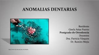 Anomalias Dentarias [upl. by Dang270]