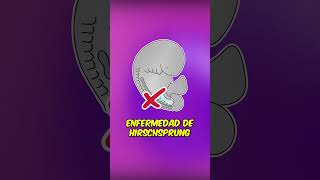 ¿Sabías que la ENFERMEDAD DE HIRSCHSPRUNG comienza en el vientre 🚼 embriologia embarazo shorts [upl. by Meerek]