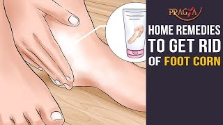 Home Remedies to Get Rid Of Foot Corn  Must Watch [upl. by Mckeon834]