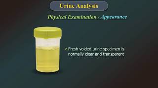 Urine Analysis [upl. by Dabney]