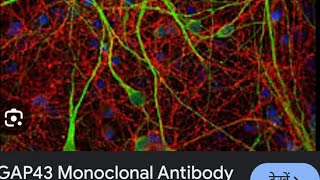 AIIMSampNEET BIOLOGY ampCSIRNET LIFESCIENCESMonoclonal ab [upl. by Quillon891]