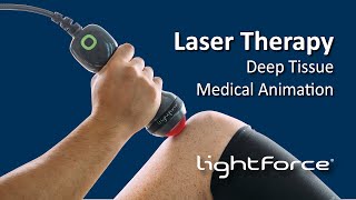 Laser Therapy  Deep Tissue Medical Animation [upl. by Aseneg]