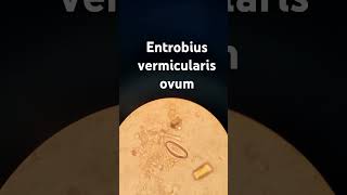 entrobius vermicularis ovum oxyuris الديدان الدبوسية [upl. by Adigun288]