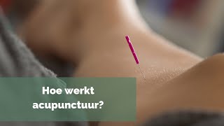 Hoe werkt acupunctuur [upl. by Macdonald]