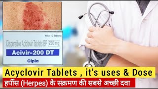 Acivir DT 800mg  Aciclovir tablets hindi  acivir 400 dt hindi  antiviral drugs in hindi  Herpex [upl. by Itnuahsa612]