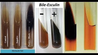 Bile Esculin Test A Biochemical Test for selective Differentiation in Enterococcus amp Streptococcus [upl. by Ecydnak60]