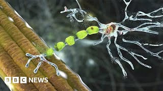 Truly remarkable drug can reverse decline caused by motor neurone disease  BBC News [upl. by Conny346]