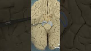 Interpeduncular fossa neuroanatomy brainstembrainWCUCOM Neuroscience [upl. by Ordnajela]