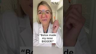 Botox made my nose BIGGER botox nosebotox drbitafarrell [upl. by Ehc]