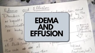 Edema and Effusion  Haemodynamic Pathology [upl. by Anaoj]