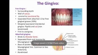 NBDE II 2 Pass Periodontics 1st video introduction Gingiva Dental board exam Decks [upl. by Ocsic]