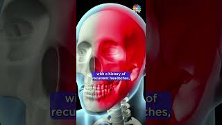 Understanding Migraines Insights from Dr K Ravishankar  Medicine Box  N18S  CNBC TV18 [upl. by Syck]