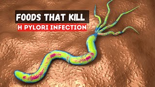 5 Foods That Kill H Pylori Infection [upl. by Aihcila]