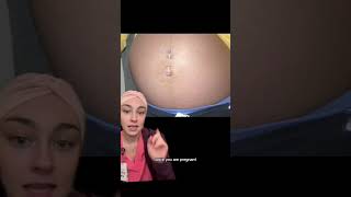 Belly button piercings in pregnancy 🤰 pregnancy nurse postpartumperiod labouranddelivery [upl. by Enert]