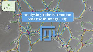 Discover the Power of Image Analysis Learn How to Analyze Tube Formation Assays with ImageJ [upl. by Tuttle]