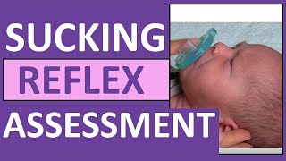 Newborn Sucking Reflex in Infant  Pediatric Nursing Assessment Exam Skill [upl. by Brier]