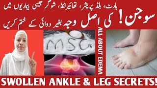 Foot And Ankle Swelling What Causes It  Edema Causes amp Treatment Listen Your Body [upl. by Emilee]