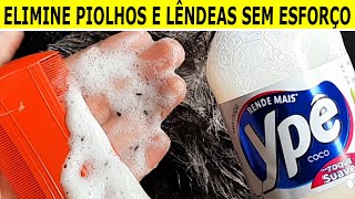 Esse produto mata PIOLHOS e LÊNDIAS com muita EFICÁCIA [upl. by Ramyar]