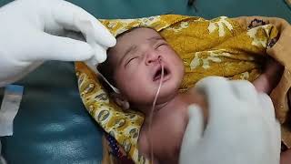 Nasogastric NGTube Insertion Suctioning NeonateNewbornOrogastricOGTube Feeding TubePaediatric [upl. by Phyllis]