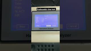 Prothrombin time test  Coagulation test  PT test  INR test  APTT test labtechnician dmlt [upl. by Nitsur]