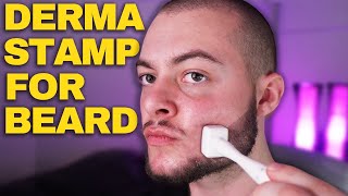 How To Derma Stamp Beard Properly Derma Stamp Tutorial Minoxidil amp Derma Stamp [upl. by Gavra]