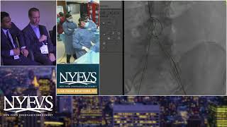 Venous Symposium Live Case 02 Operator A Fischman Venous Symposium [upl. by Madel]